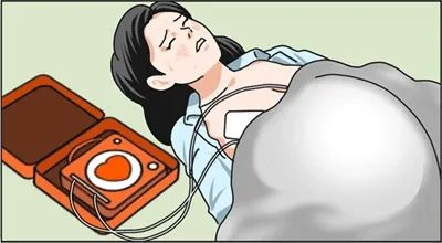 倒在AED面前的她们——日本人为何“不救女人”? 倒在AED面前的她们——日本人为何“不救女人”?