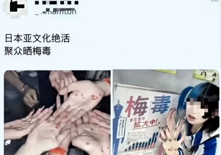 “慢脚”惹上“梅毒妆”,东亚小孩彻底癫了? “慢脚”惹上“梅毒妆”,东亚小孩彻底癫了?