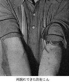 在日本染上毒品,记录会被谁知道? 在日本染上毒品,记录会被谁知道?