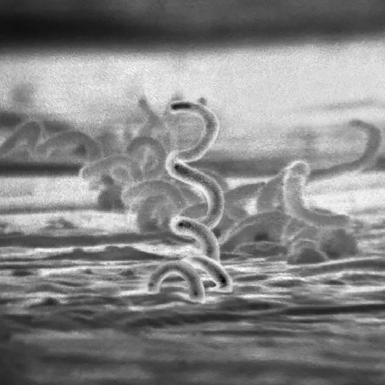 日本飙升的梅毒,到底是什么毒? 日本飙升的梅毒,到底是什么毒?