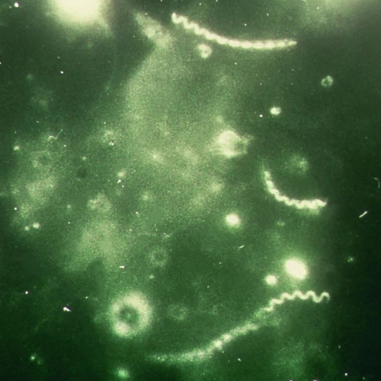 日本飙升的梅毒,到底是什么毒? 日本飙升的梅毒,到底是什么毒?