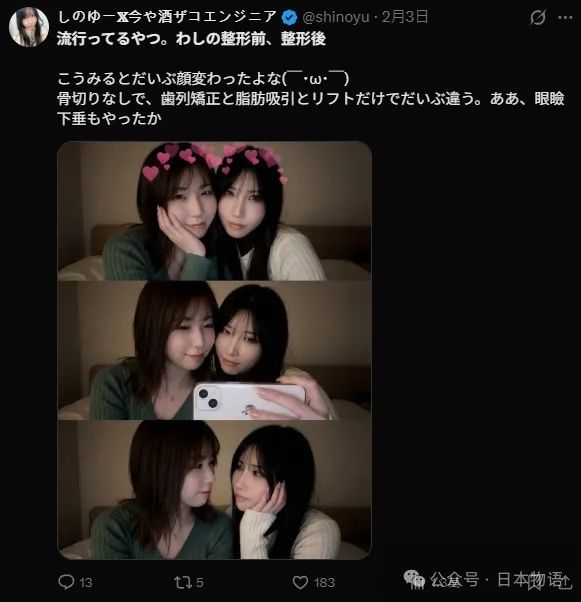 日本妹子用AI融合自己整容前后的合影,看着看着就看哭了…… 日本妹子用AI融合自己整容前后的合影,看着看着就看哭了……