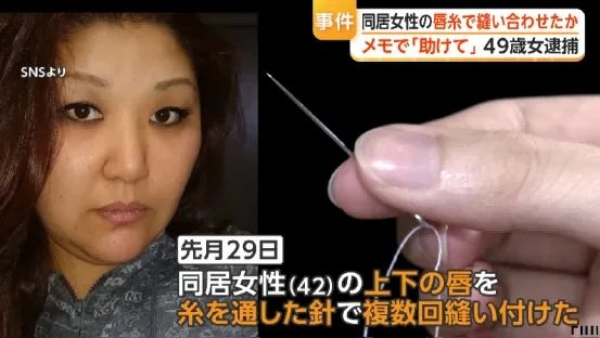 日本变态女子缝合室友双唇,竟是为了…?!电锯惊魂竟然在现实上演… 日本变态女子缝合室友双唇,竟是为了…?!电锯惊魂竟然在现实上演…